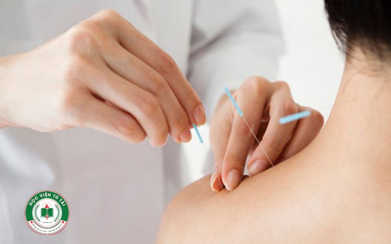 Vì sao nên học Liên thông Cao đẳng Y học cổ truyền ngay hôm nay? 5 Mục tiêu đào tạo của chương trình Liên thông Cao đẳng Y học cổ truyền