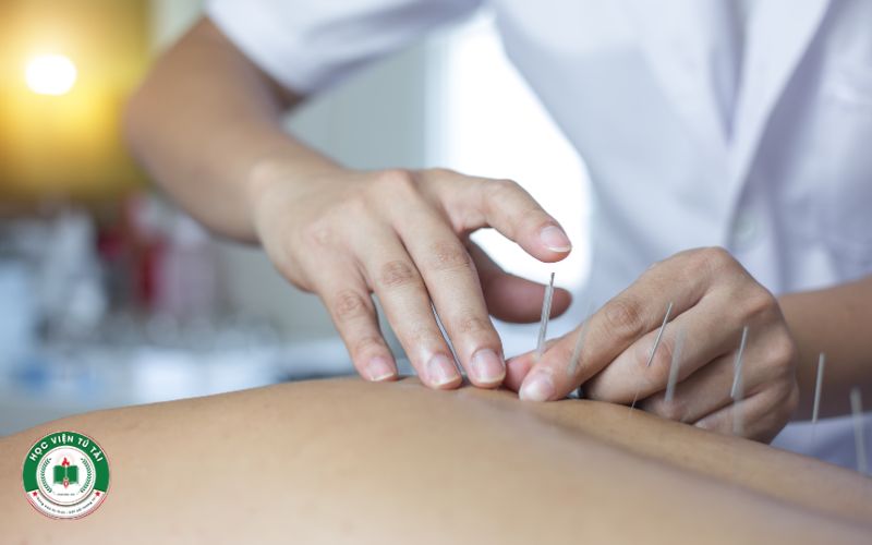 Nội dung học tập và kiến thức cung cấp khi theo học Trung cấp Y học cổ truyền